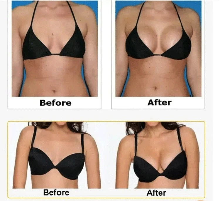 BEFORE-AND-AFTER BEFORE-AND-AFTER